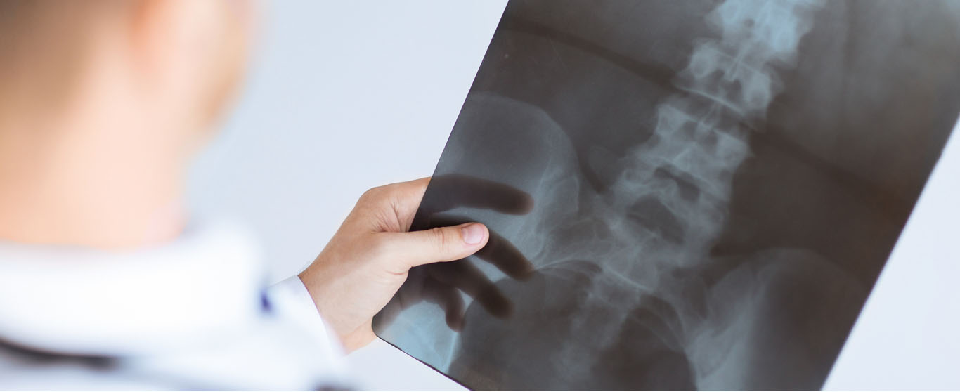 Clinician reviewing a spine X-ray